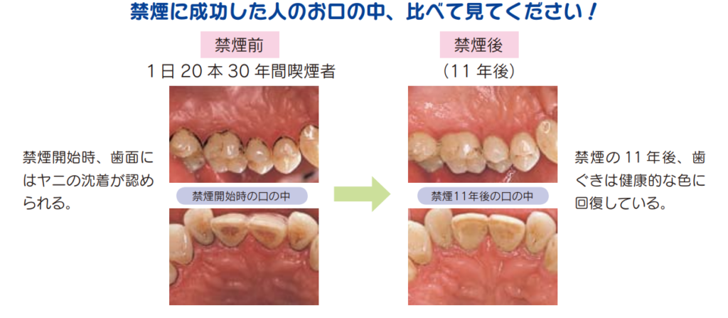 タバコ やめて 大切な人に伝えたい10のこと 後編 ファストドクター 夜間往診 自宅で診察 オンライン診療 国内最大件の往診実績